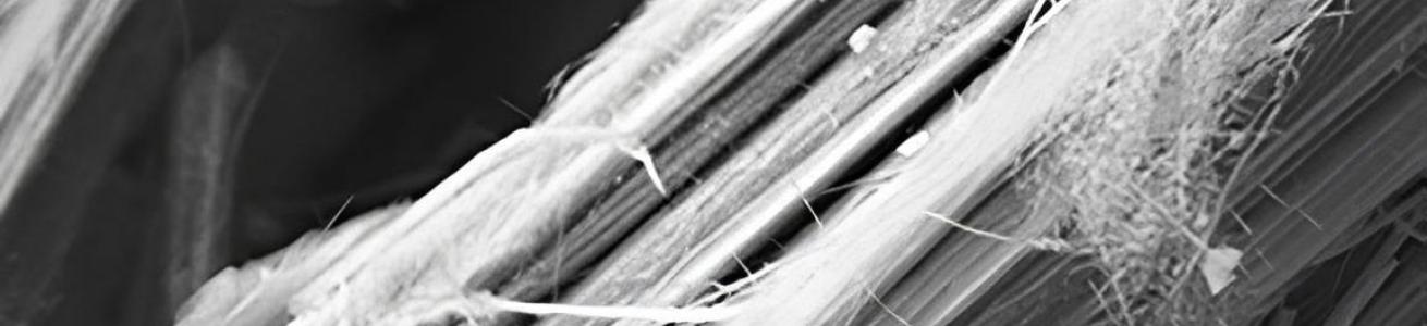 Immagine al microscopio elettronico a scansione di fibre di Erionite